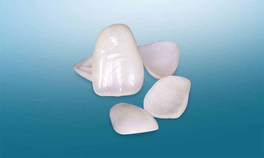مزایای لمینت IPS