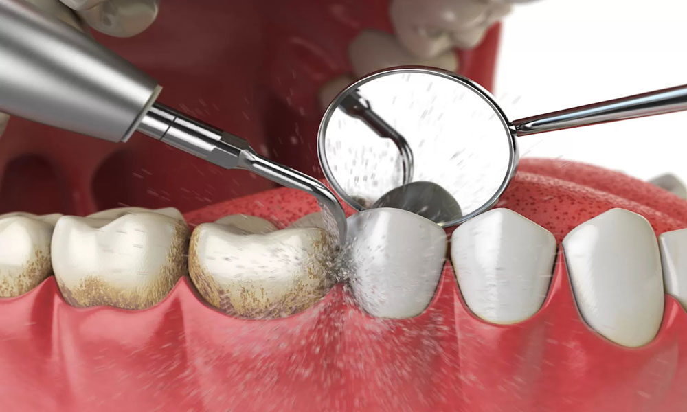 ساعات اولیه، حساس ترین زمان مراقبت