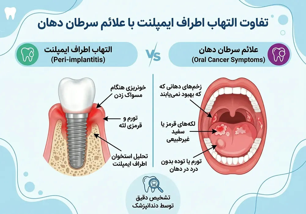 تفاوت التهاب اطراف ایمپلنت با علائم سرطان دهان تفاوت التهاب اطراف ایمپلنت با علائم سرطان دهان