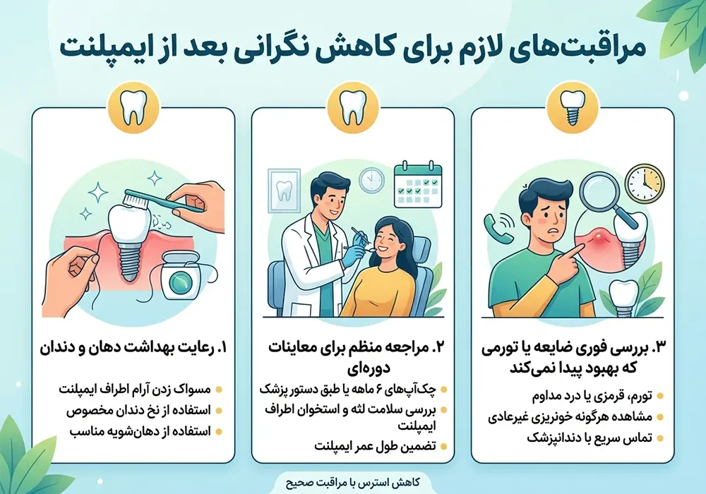 مراقبت بعد از ایمپلنت مراقبت های لازم برای کاهش نگرانی بعد از ایمپلنت